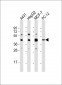 MAPK3 Antibody (N-term)